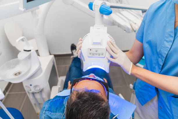 Teeth Whitening in Riyadh