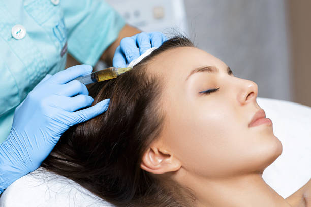 PRP Hair Treatment in Abu Dhabi