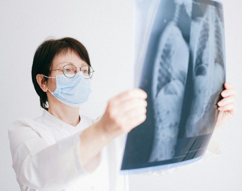 Symptoms Lung Cancer Stages